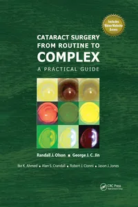 Cataract Surgery from Routine to Complex_cover