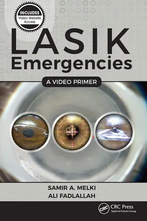 LASIK Emergencies: A Video Primer