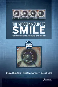 The Surgeon’s Guide to SMILE_cover