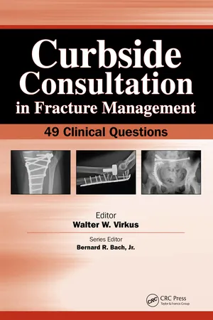 Curbside Consultation in Fracture Management