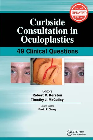 Curbside Consultation in Oculoplastics