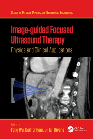 Image-guided Focused Ultrasound Therapy