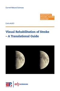 Visual Rehabilitation of Stroke_cover