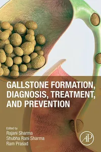 Gallstone Formation, Diagnosis, Treatment and Prevention_cover