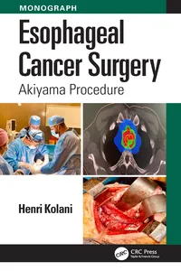 Esophageal Cancer Surgery_cover