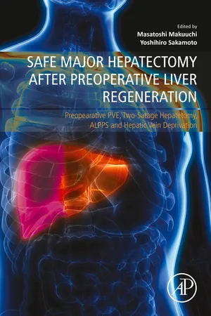 Safe Major Hepatectomy after Preoperative Liver Regeneration