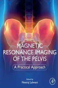 Magnetic Resonance Imaging of The Pelvis_cover