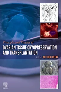 Principles and Practice of Ovarian Tissue Cryopreservation and Transplantation_cover