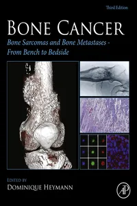 Bone Cancer_cover