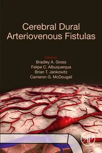 Cerebral Dural Arteriovenous Fistulas_cover