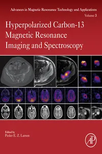 Hyperpolarized Carbon-13 Magnetic Resonance Imaging and Spectroscopy_cover