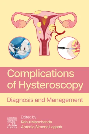 Complications of Hysteroscopy