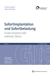 Sofortimplantation und Sofortbelastung_cover