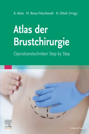 Atlas der Brustchirurgie