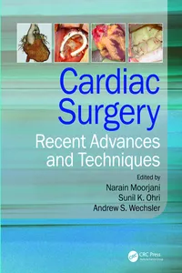 Cardiac Surgery_cover