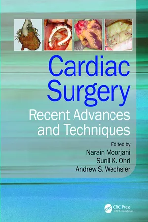 Cardiac Surgery