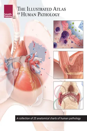 The Illustrated Atlas of Human Pathology