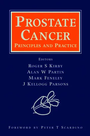 Prostate Cancer