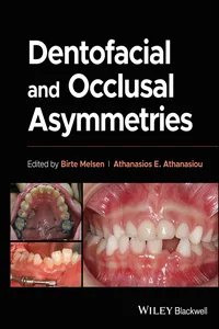 Dentofacial and Occlusal Asymmetries_cover