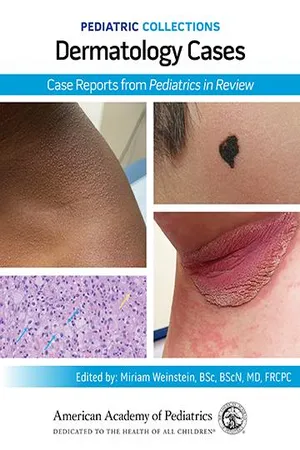 Pediatric Collections: Dermatology Cases: Case Reports from Pediatrics in Review