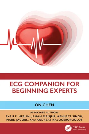 ECG Companion For Beginning Experts