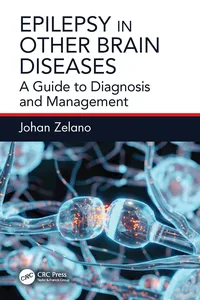 Epilepsy in Other Brain Diseases_cover