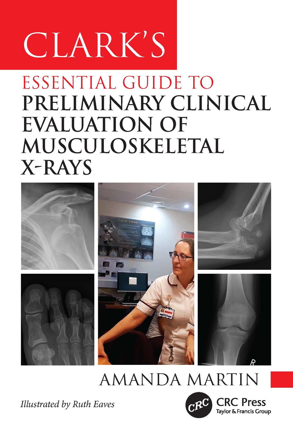 PDF] Clark's Essential Guide to Preliminary Clinical Evaluation of