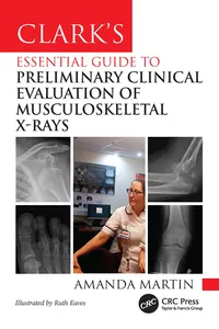 Clark’s Essential Guide to Preliminary Clinical Evaluation of Musculoskeletal X-rays_cover