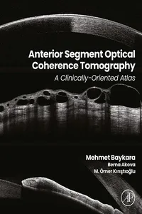 Anterior Segment Optical Coherence Tomography_cover