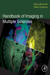 Handbook of Imaging in Multiple Sclerosis_cover
