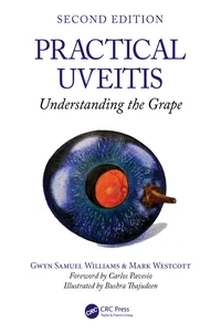 Practical Uveitis_cover