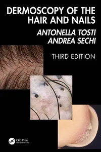 Dermoscopy of the Hair and Nails 3e_cover