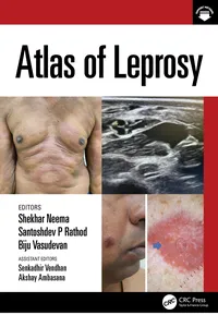 Atlas of Leprosy_cover