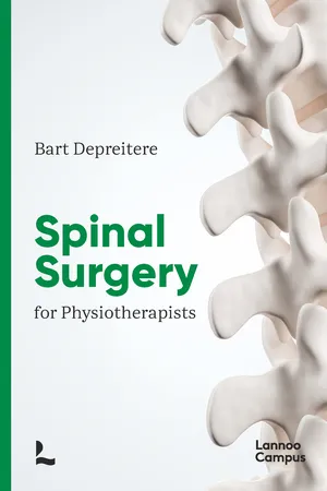 Spinal surgery for physiotherapists