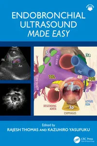 Endobronchial Ultrasound Made Easy_cover