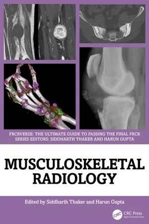 Musculoskeletal Radiology
