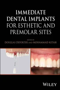 Immediate Dental Implants for Esthetic and Premolar Sites_cover