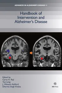 Handbook of Intervention and Alzheimer’s Disease_cover