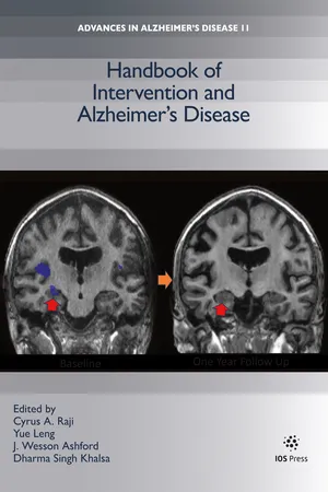 Handbook of Intervention and Alzheimer’s Disease