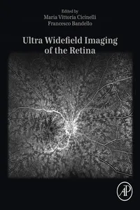 Ultra Widefield Imaging of the Retina_cover