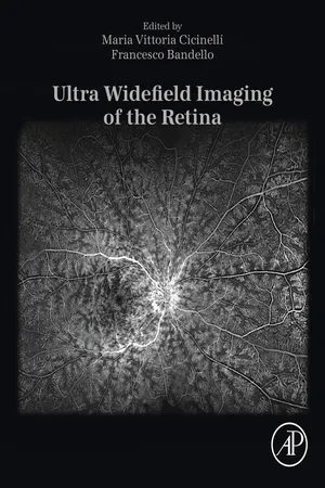 Ultra Widefield Imaging of the Retina