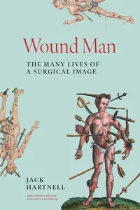 Wound Man_cover