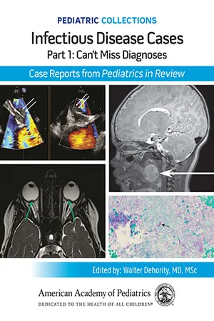 Pediatric Collections: Infectious Disease Cases: Part 1: Can't Miss Diagnoses: Case Reports from Pediatrics in Review