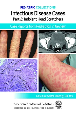Pediatric Collections: Infectious Disease Cases: Part 2: Indolent Head Scratchers: Case Reports from Pediatrics in Review
