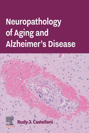 Neuropathology of Aging and Alzheimer's Disease