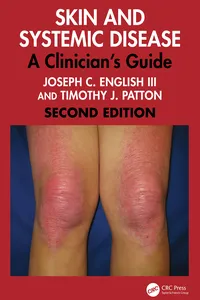 Skin and Systemic Disease_cover