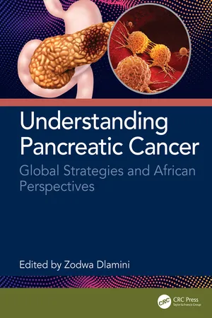 Understanding Pancreatic Cancer