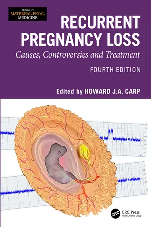 Recurrent Pregnancy Loss