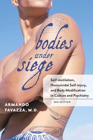 Bodies under Siege