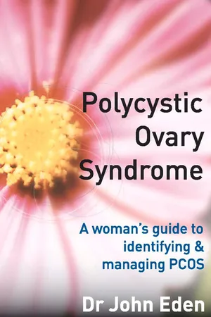 Polycystic Ovary Syndrome